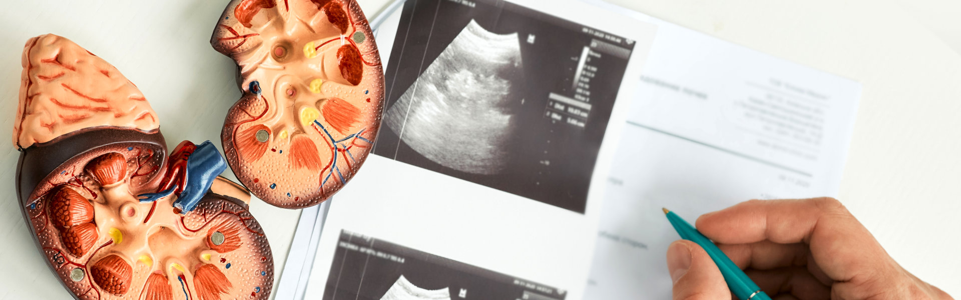 kidney ultrasound